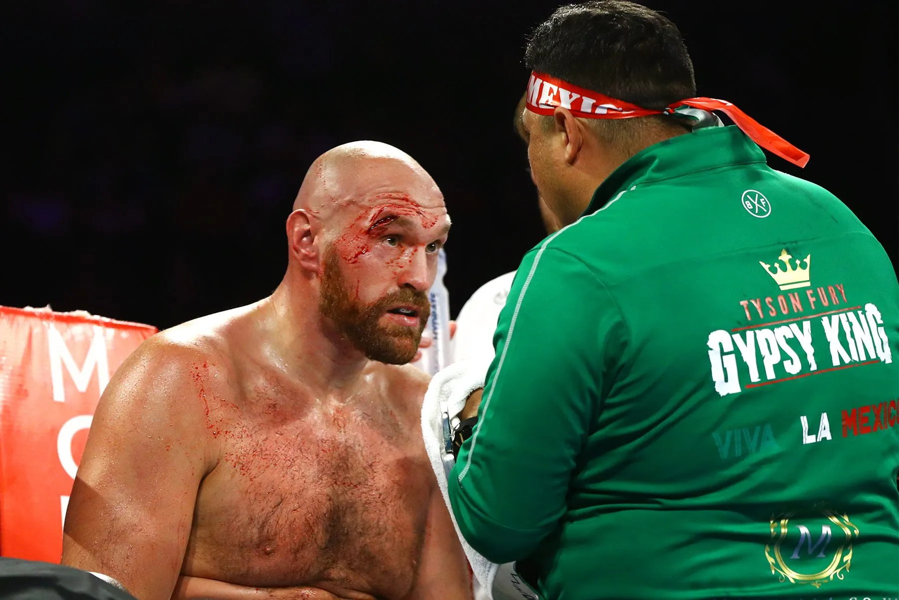 0000000000Tyson Fury Capetillo