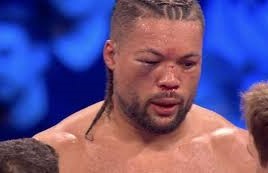 Warren dichiara : -Joe Joyce  vuole rientrare. Possibile un match contro  Tony Yoka. 