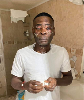 Rigondeaux sfigurato